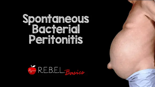 Spontaneous Bacterial Peritonitis : 自发性细菌性腹膜炎