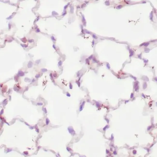 Treponema Pallidum Aemagglutination Assay : 梅毒螺旋体血凝试验