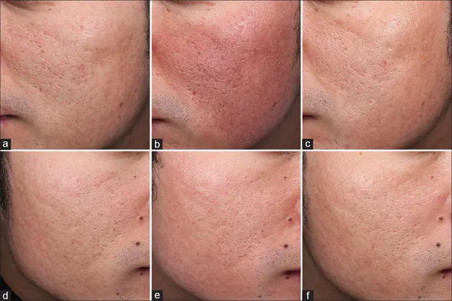 Dermal Exposure Research Program : 皮肤接触研究计划