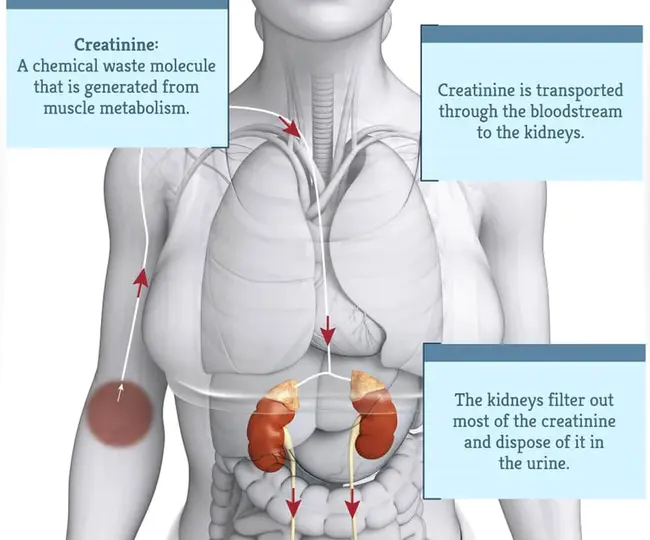 Creatinine PhosphoKinase : 肌酸激酶