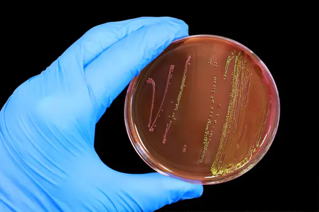 Escherichia Coli : 大肠杆菌