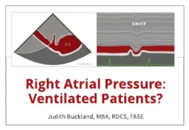 Right Atrial Pressure : 右心房压