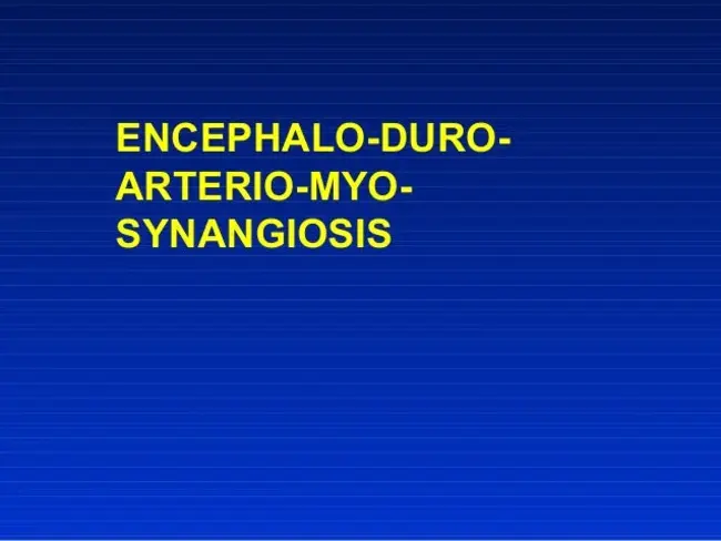 Encephalo-Duro-Arterio-Myo-Synangiosis : 脑-硬-动脉-肌-血管连接