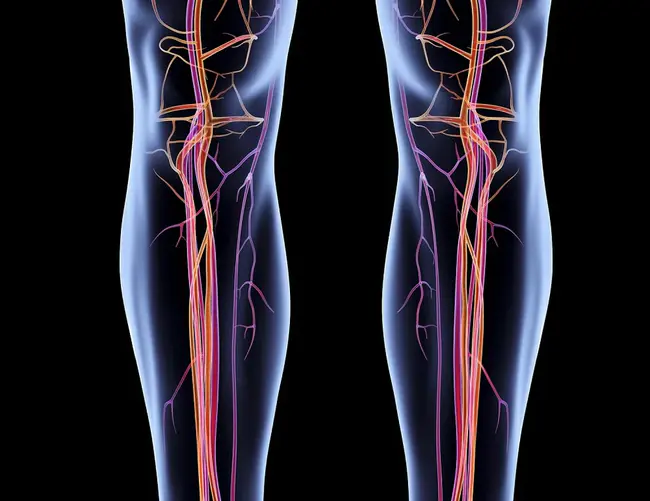 TransMyocardial Revascularization : 心肌血运重建