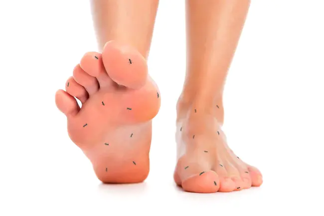 Peripheral Diabetic Neuropathy : 周围性糖尿病神经病变