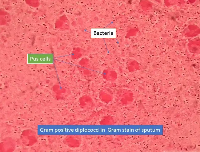 Gram-Positive Cocci : 革兰氏阳性球菌