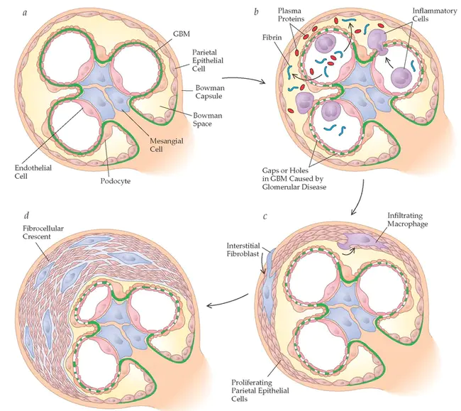 Glomerular Basement Membrane : 肾小球基底膜