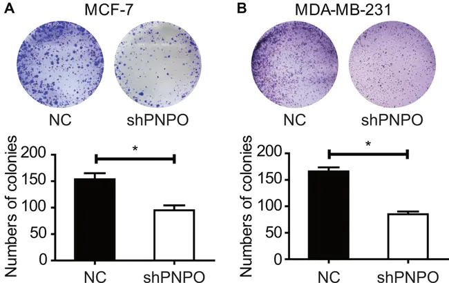 Porcine Thyroid PerOxidase : 猪甲状腺过氧化物酶