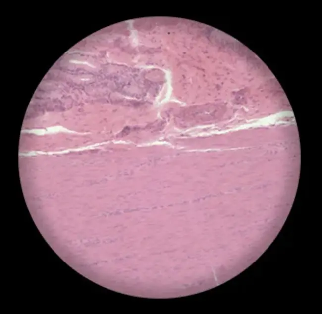 Smooth Muscle Cell : 平滑肌细胞