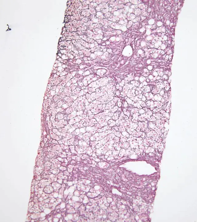 ReticuloEndothelial System : 网状内皮系统