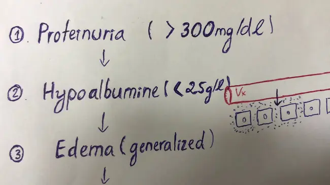 Nephrotic Syndrome : 肾病综合征