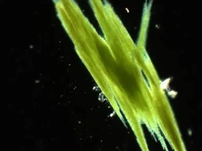 Aphanizomenon Flos-Aquae : 水花束丝藻