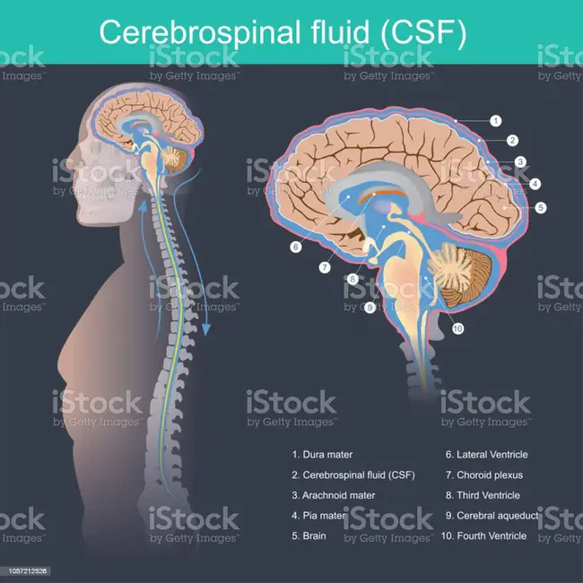 CerebroSpinal Meningitis : 脑脊髓膜炎