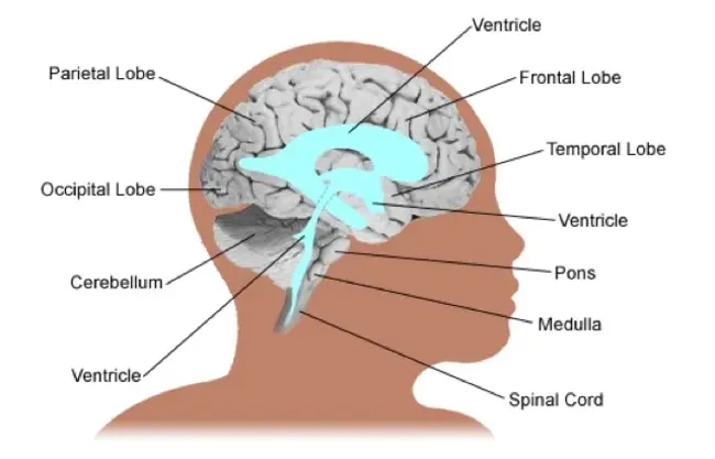 IntraVentricular Hemorrhage : 脑室内出血