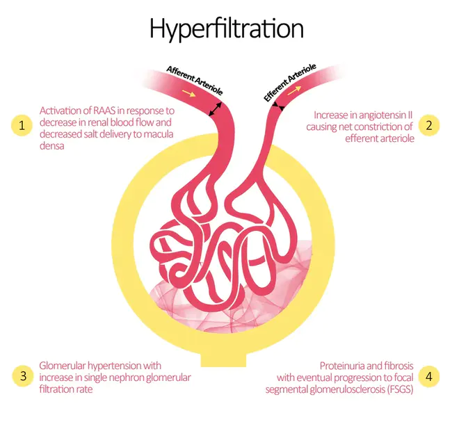 HyperFiltration : 超滤过