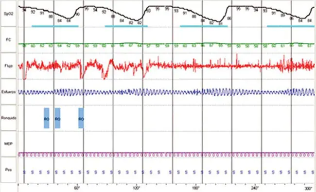 Overall Sound Pressure Level : 总声压级