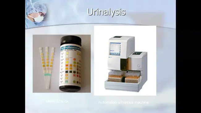 Urine Monitoring Investigation : 尿监测调查