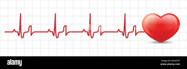 Vector CardioGram : 向量心动图