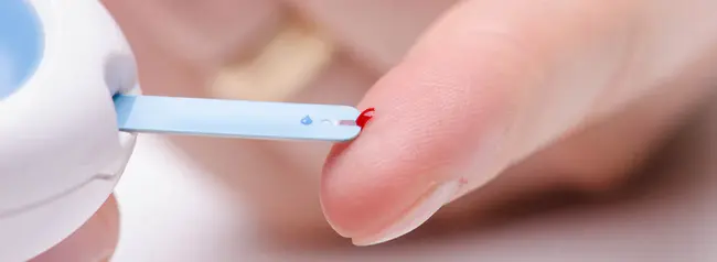 Capillary Blood Glucose : 毛细血管血糖