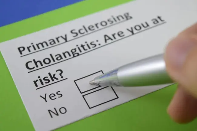 Primary Sclerosing Cholangitis : 原发性硬化性胆管炎