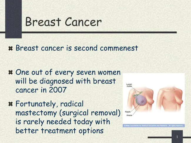 Breast Cancer Prevention Trial : 乳腺癌预防试验