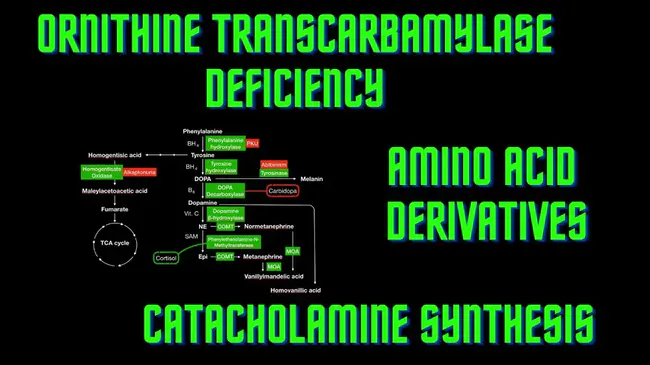 Ornithine Transcarbamylase Deficiency : 鸟氨酸转氨酶缺乏