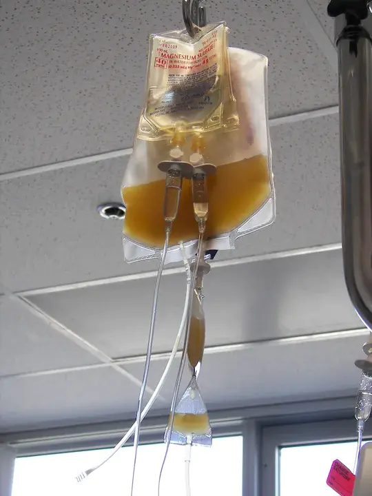 Platelet Transfusion Reaction : 血小板输注反应