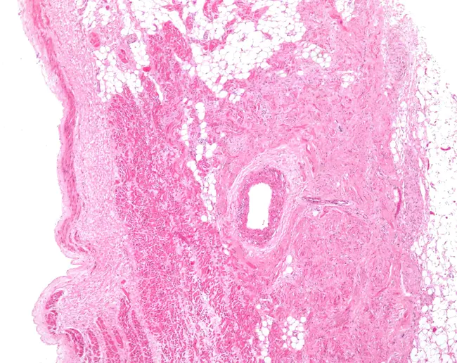 Sino-Atrial Node : 窦房结