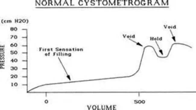 CystoMetroGram : 膀胱造影照片