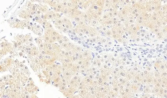 MonoacylGLycerol Lipase : 单酰甘油脂肪酶