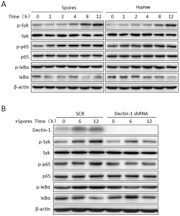 Fms-like tyrosine kinase 3 : fms样酪氨酸激酶3