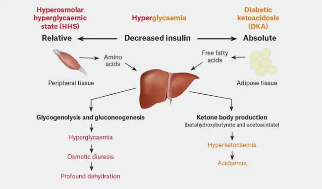 HyperOsmolar Non-Ketotic : 高渗非酮症