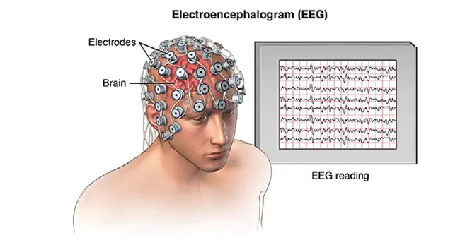 ElectroEncephaloGraphy : 脑电图