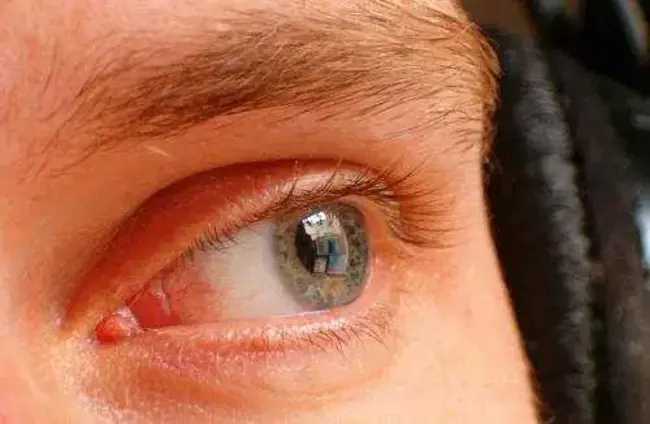 Vestibulo-Ocular Reflex : 前庭-眼反射