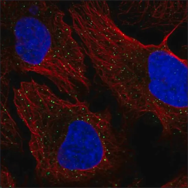 AntiGene-AntiBody complex : 抗原抗体复合物