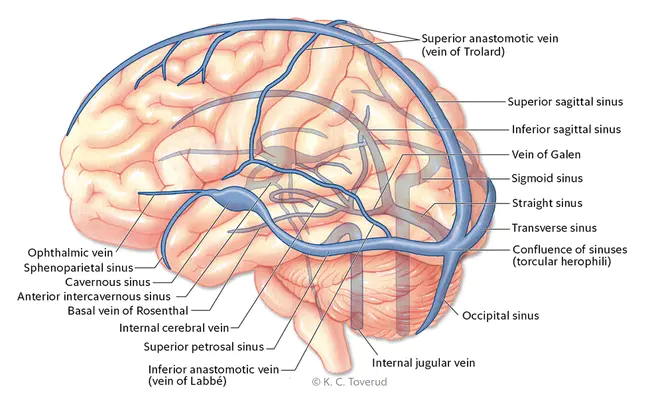 Cerebral SinoVenous Thrombosis : 脑静脉血栓形成