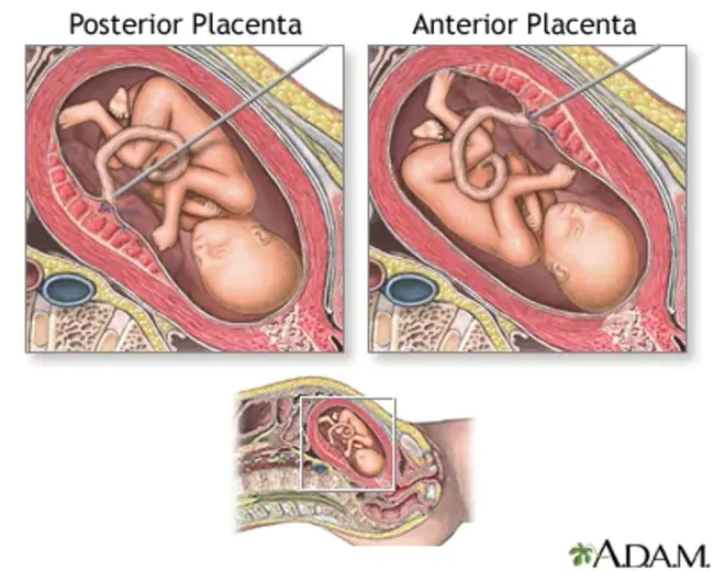 Percutaneous Umbilical Blood Sampling : 经皮脐血取样