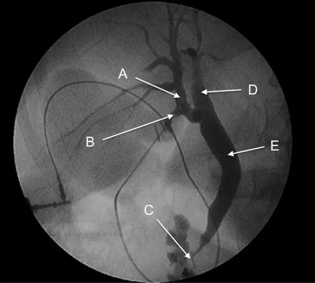 Intraoperative echocardiography : 术中超声心动图