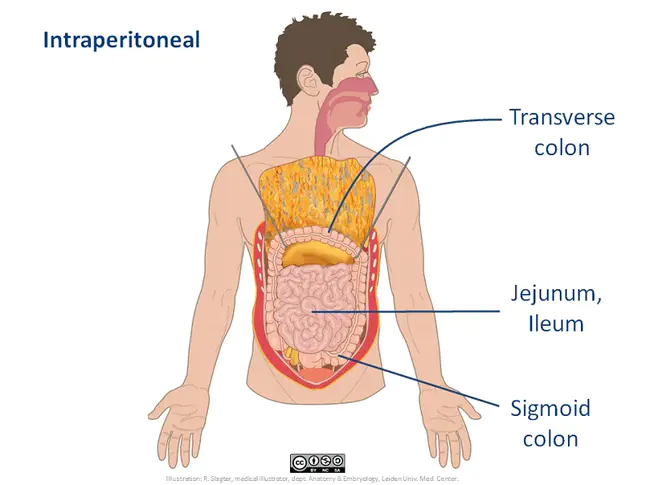 intraperitoneal : 腹腔内