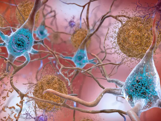 Alzheimer Precursor Protein : 阿尔茨海默病前体蛋白