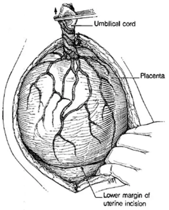 Obstetrics and Gynecology : 妇产科