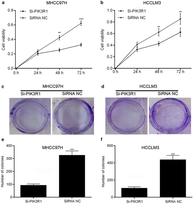 Hemopoietic Cell Kinase : 造血细胞激酶