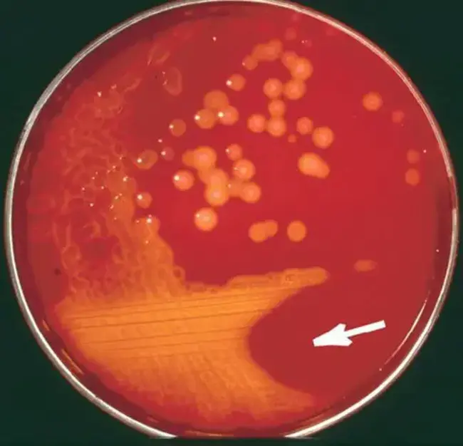 Group A Beta-Haemolytic Streptococcus : A组β溶血性链球菌