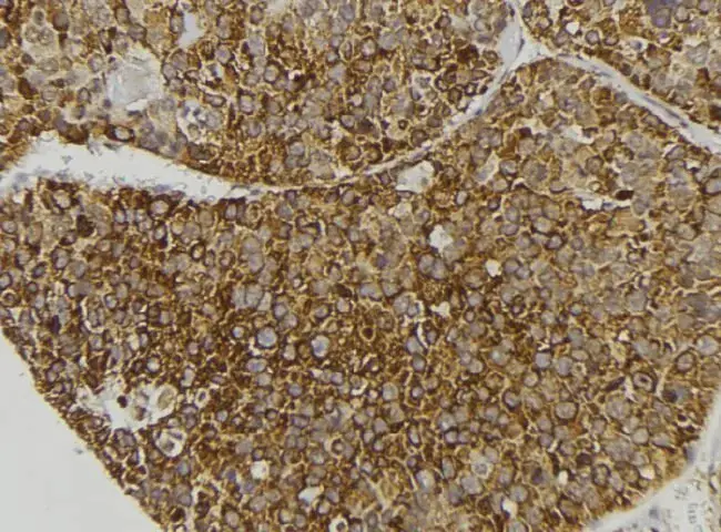 Apolipoprotein A-I : 载脂蛋白A-I