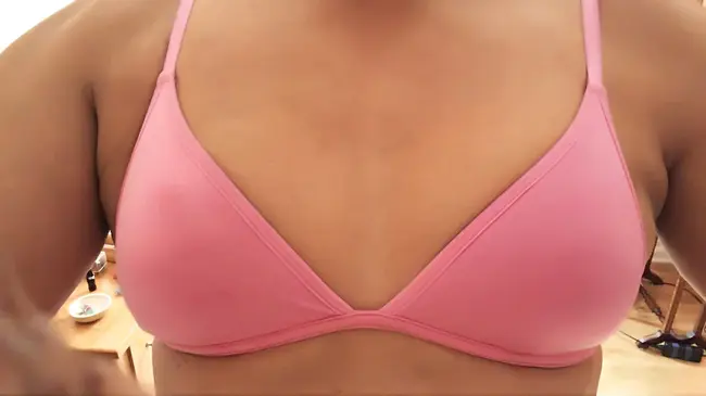 Breast Abscess : 乳房脓肿