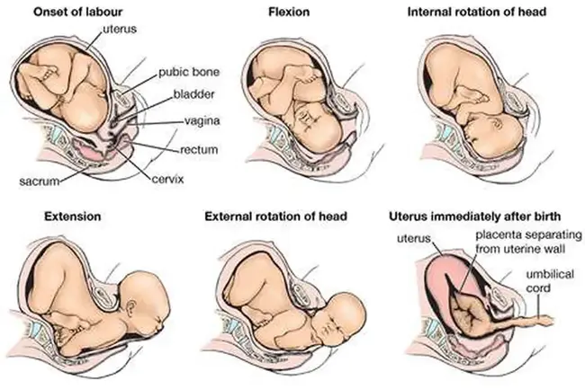 Flexion, Abduction and External Rotation : 弯曲、外展和外旋