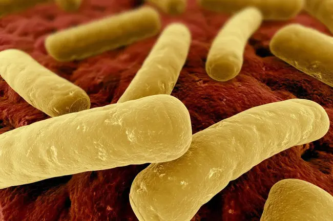 Clostridium difficile infection : 艰难梭菌感染