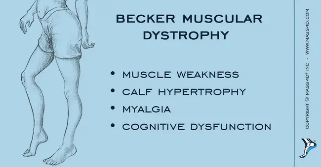 Becker Muscular Dystrophy : 贝克肌营养不良