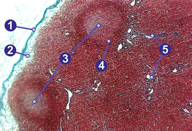 lymph nodes(s) : 淋巴结