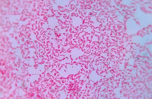 Gram-negative intracellular diplococci : 革兰氏阴性细胞内双球菌